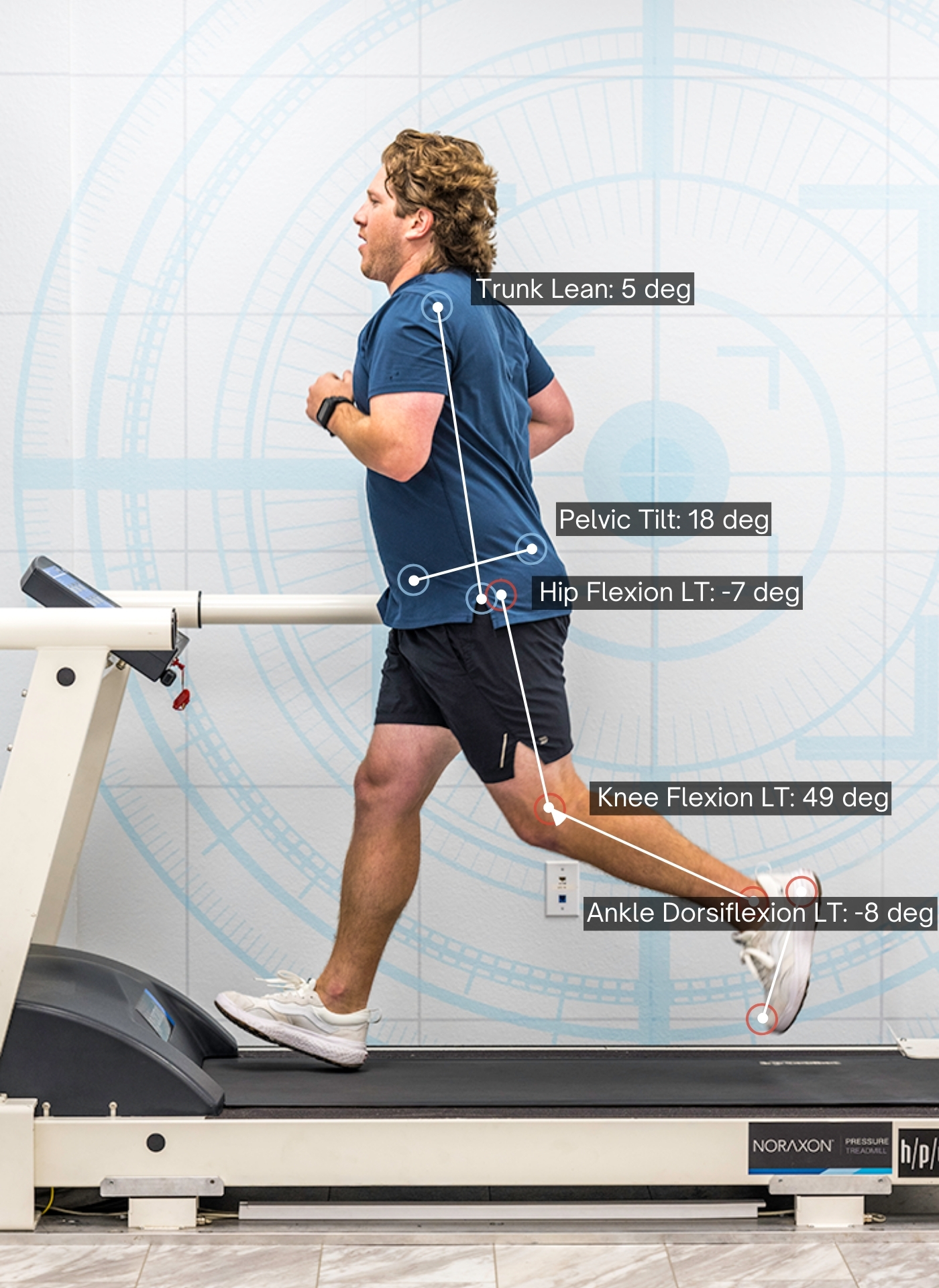 A man runs on a treadmill with biomechanical analysis data displayed: Trunk Lean 5º, Pelvic Tilt 18º, Hip Flexion LT -7º, Knee Flexion LT 49º, Ankle Dorsiflexion LT -8º.